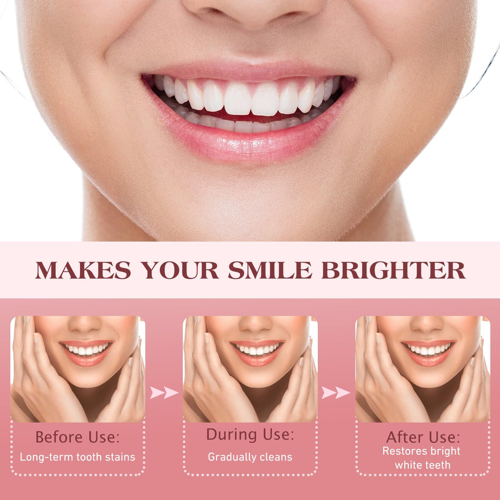 SP-8 Probiotic Ultra Whitening Toothpaste Upgraded 2.0 – Fluoride-Free, Probiotic-Infused Formula for Gum Health, Enamel Strength & Fresh Breath