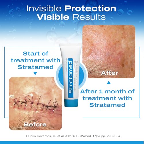 Stratamed Advanced Film-Forming Wound Dressing | Flexible Protective Layer for Open Wounds & Damaged Skin | 50g
