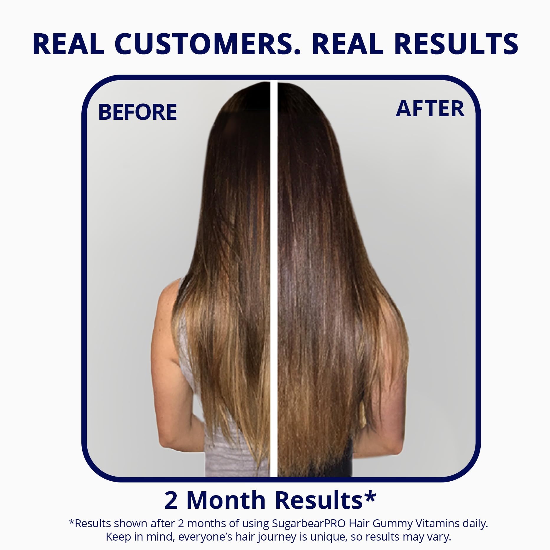 SugarBearPro Hair Vitamin Gummy – Extra Strength Biotin 6000mcg (6-Month Supply) | Vegan, Kosher, Halal, Cruelty-Free