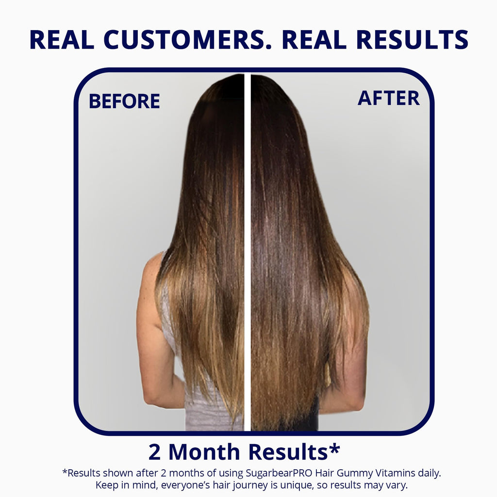 SugarBearPro Hair Vitamin Gummy – 3 Month, Extra Strength Biotin 6000mcg | Vegan, Kosher, Halal
