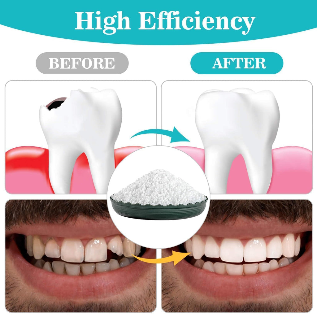 Sukh 10.9oz Moldable Thermoplastic Beads – DIY Tooth Repair Kit