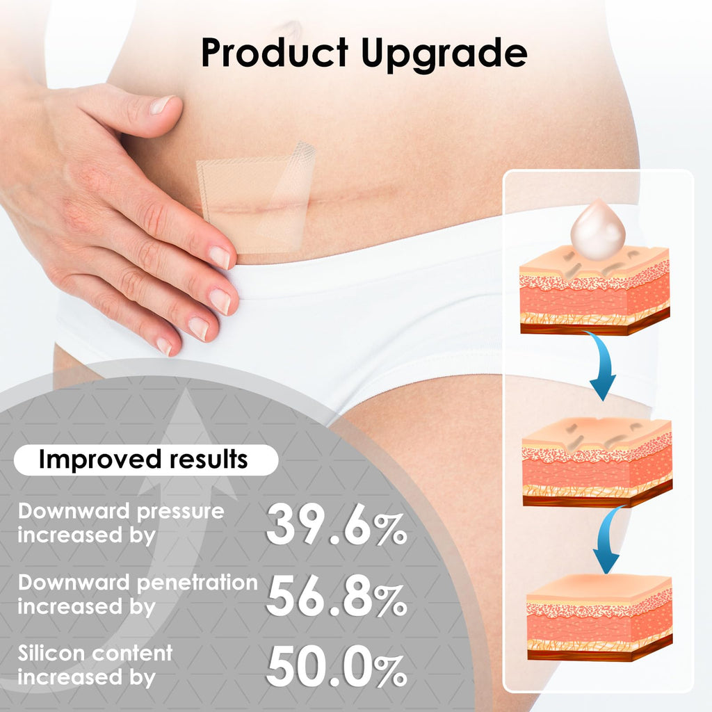 SWturK Silicone Scar Sheets Roll – Medical-Grade Scar Tape for Surgical Scars, C-Section, Tummy Tuck (1.6-in x 60-in)