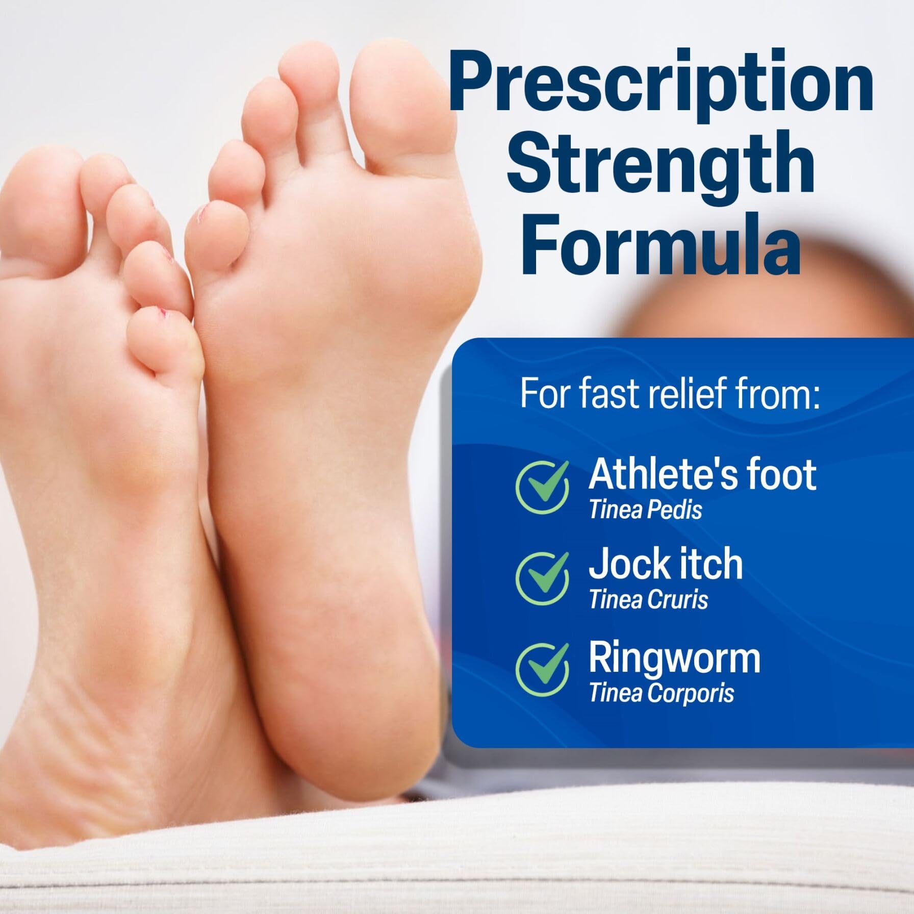 TARO Terbinafine 1% Cream – Fast Athlete’s Foot Relief, 5-Pack