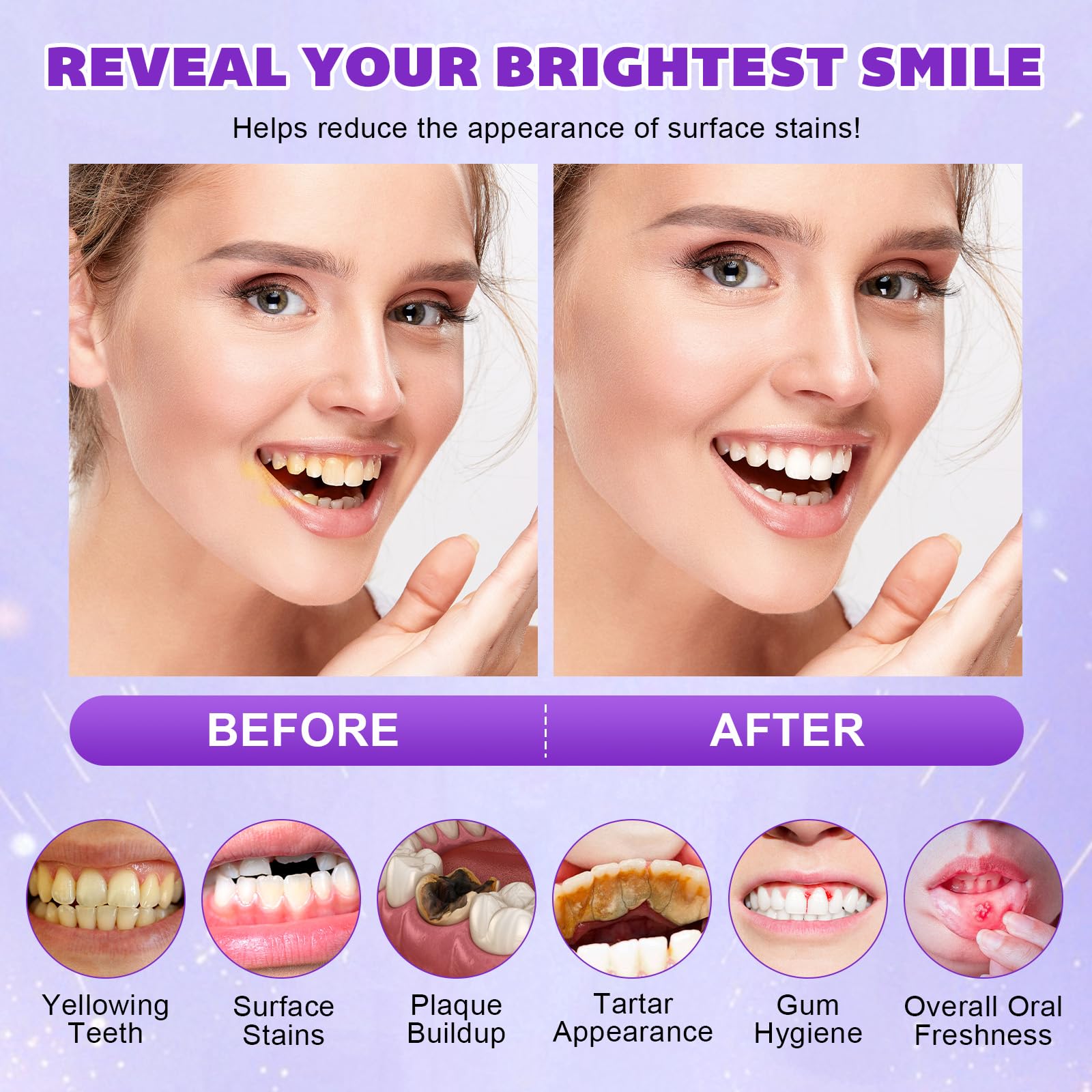 Teeth Whitening Powder with PAP+ – Peroxide-Free, Enamel Safe (35g)