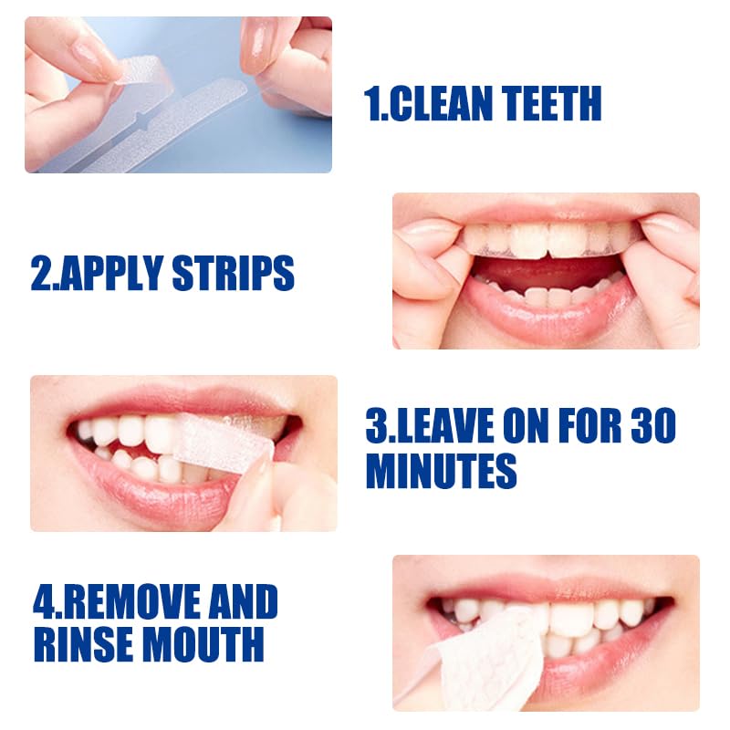 Teeth Whitening Strips – Mint 14-Count | 7-Day Whitening Kit