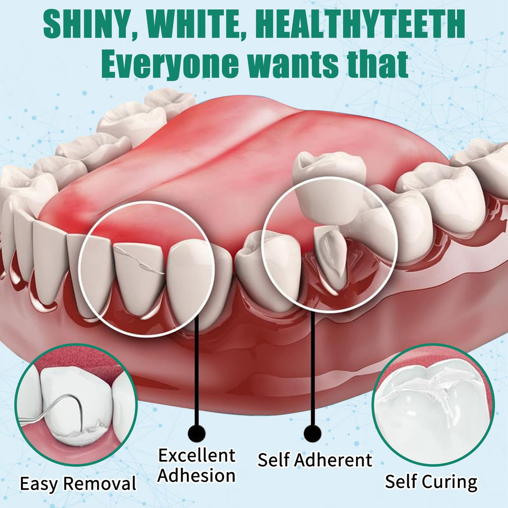 Temporary Tooth Repair Kit – Zinc Oxide Eugenol Cement for Crowns & Bridges | Perfect Smile (6)