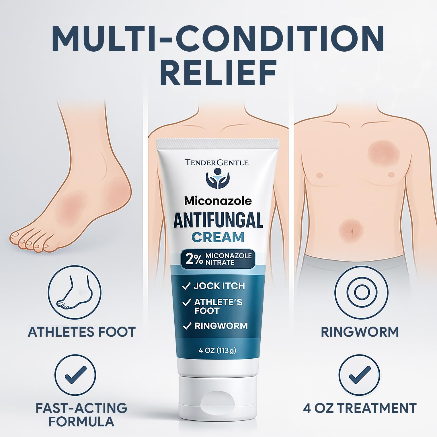 TenderGentle Miconazole Antifungal Cream for Skin – 4 oz Tube, Case of 24 | 2% Miconazole Nitrate