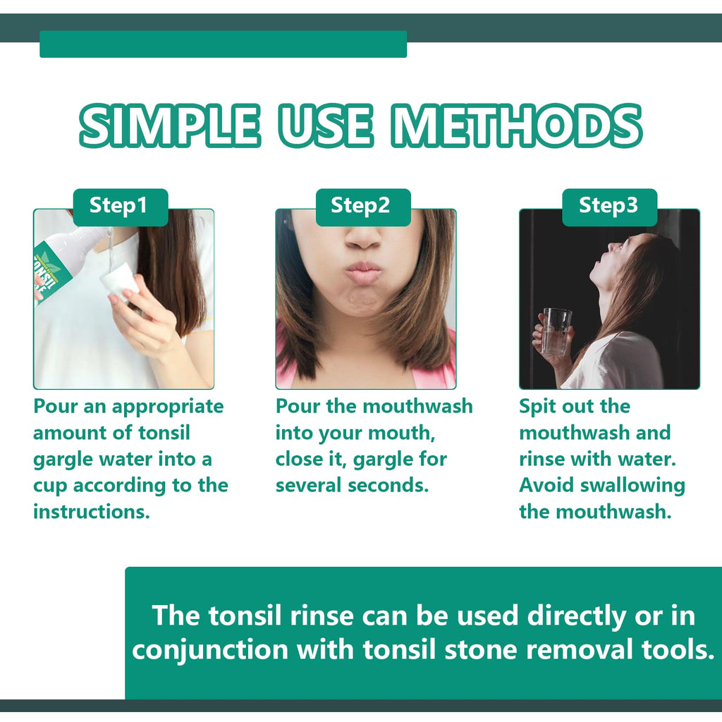 Tonsil Stone Remover with Alcohol-Free Oral Rinse – 300ml (10.14 fl oz) | Soothe Tonsils & Freshen Breath