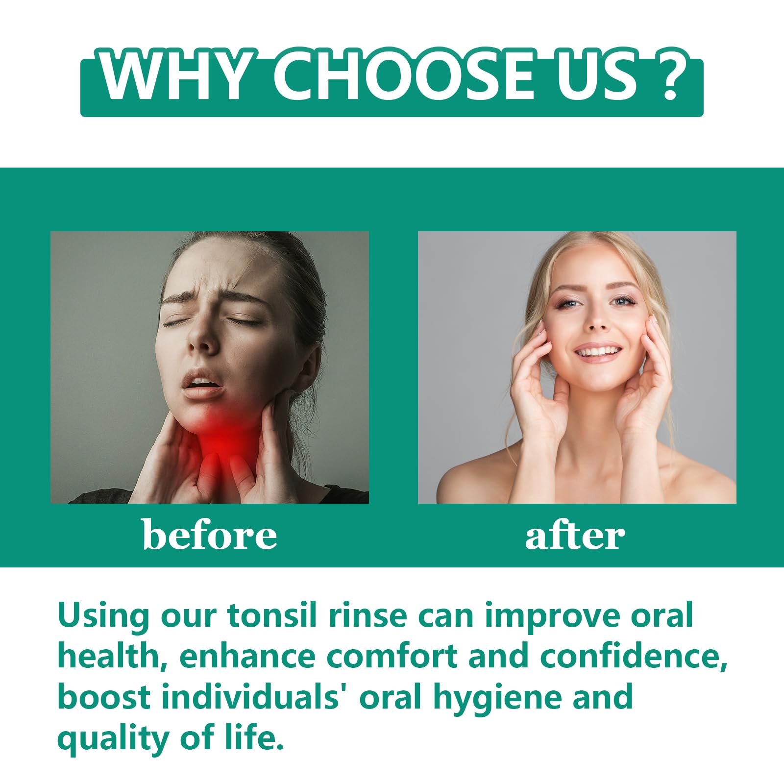 Tonsil Stone Remover with Alcohol-Free Oral Rinse – 300ml (10.14 fl oz) | Soothe Tonsils & Freshen Breath