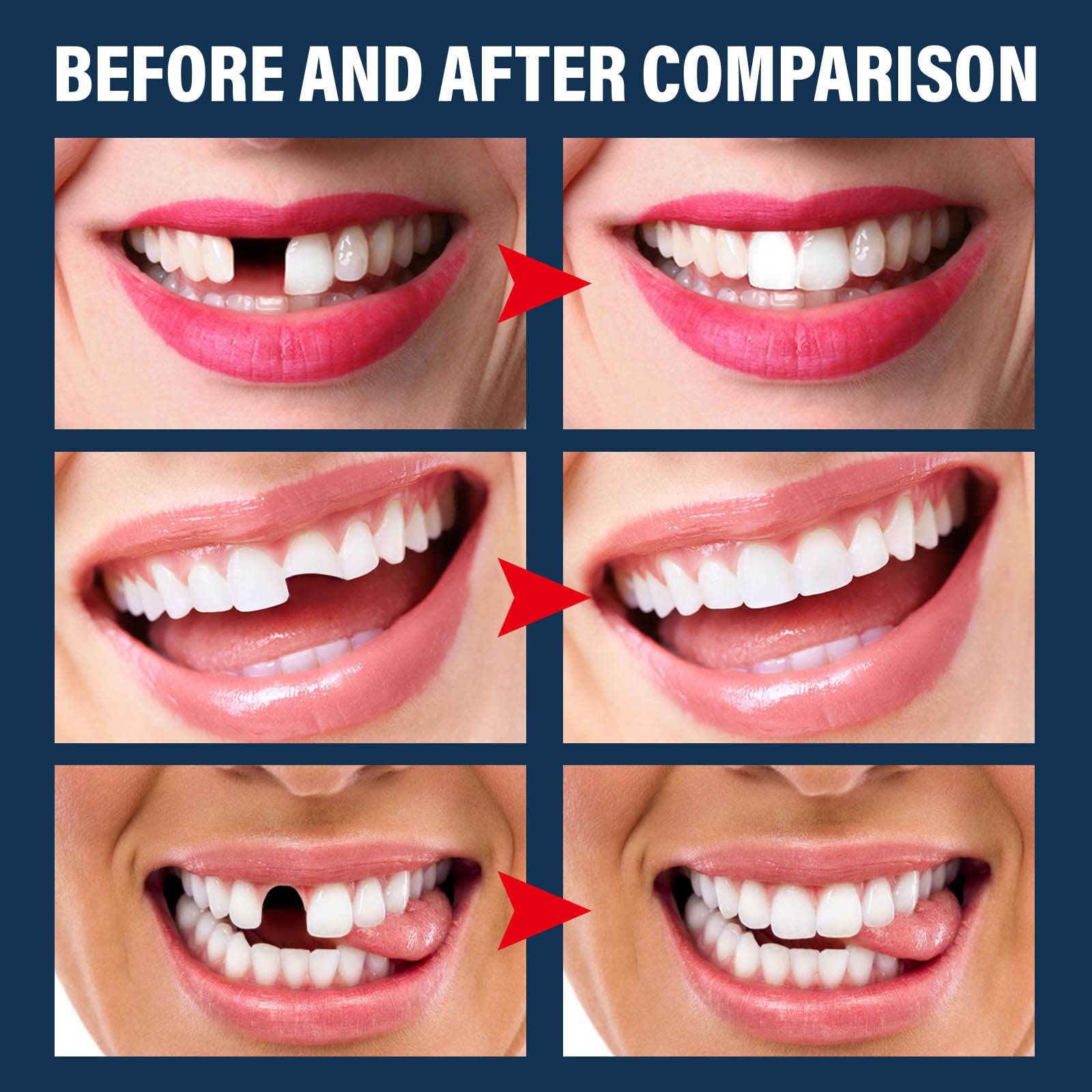 Tooth Repair Kit - Temporary Fake Teeth Replacement with Dental Mirror Tools | Ceonam