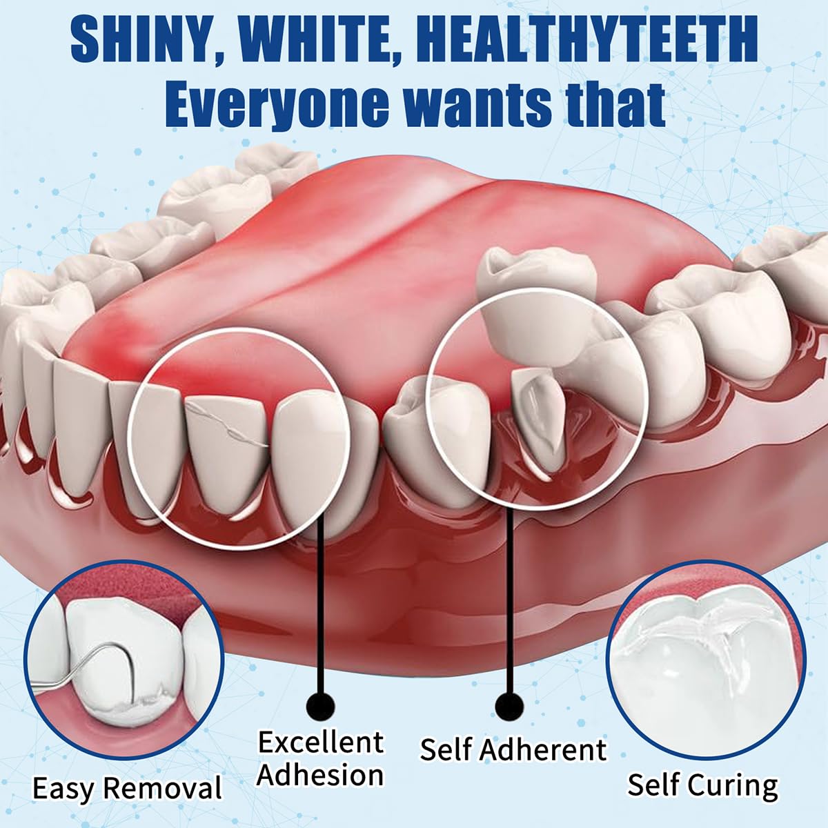 Tooth Repair Kit – Temporary Filling for Missing & Broken Teeth (Men & Women)