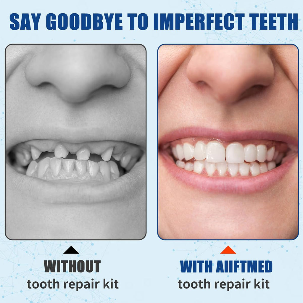 Tooth Repair Kit – Temporary Filling for Missing & Broken Teeth (Men & Women)