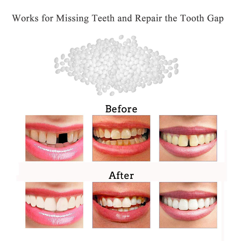 Tooth Repair Kit - Thermal Beads for Filling Gaps & Broken Teeth