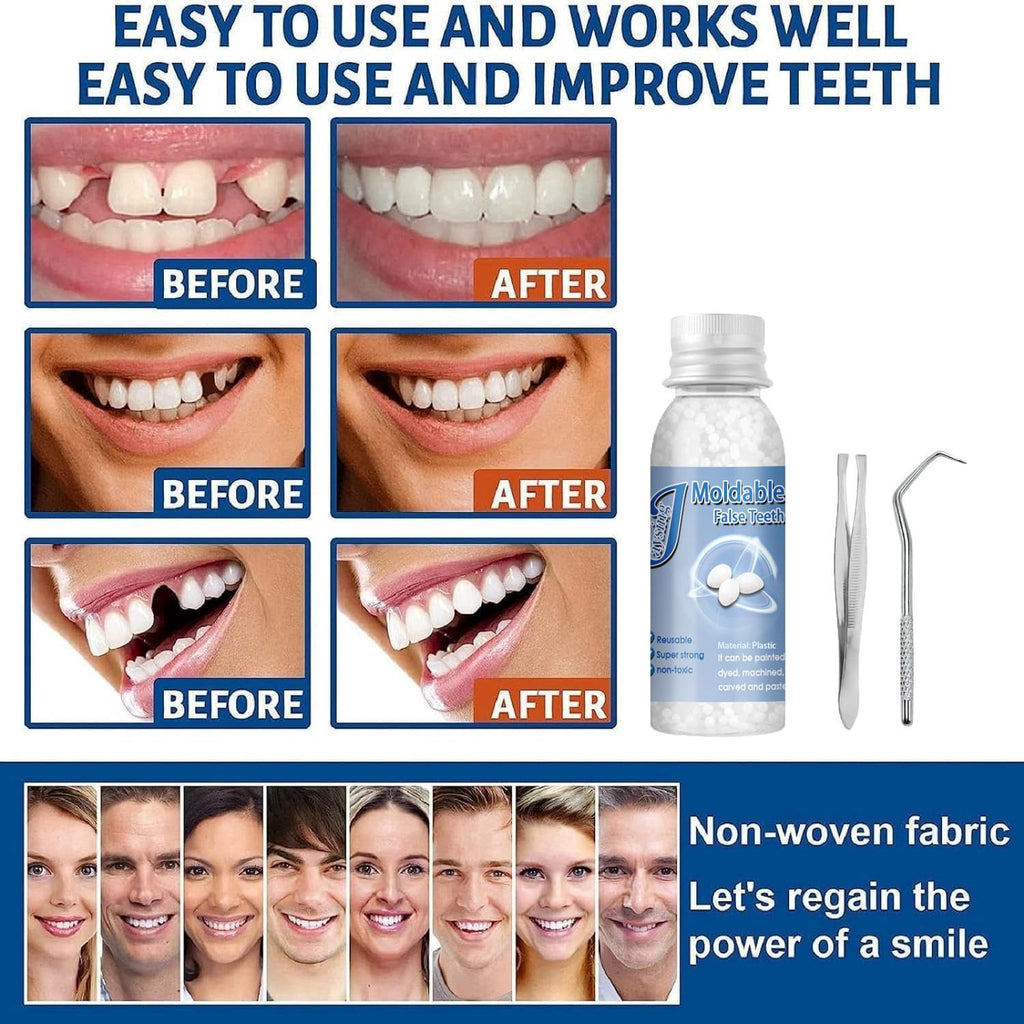 Tooth Repair Kits: 2x30ml Moldable Denture Beads + 4 Tools (2+4 Pack)