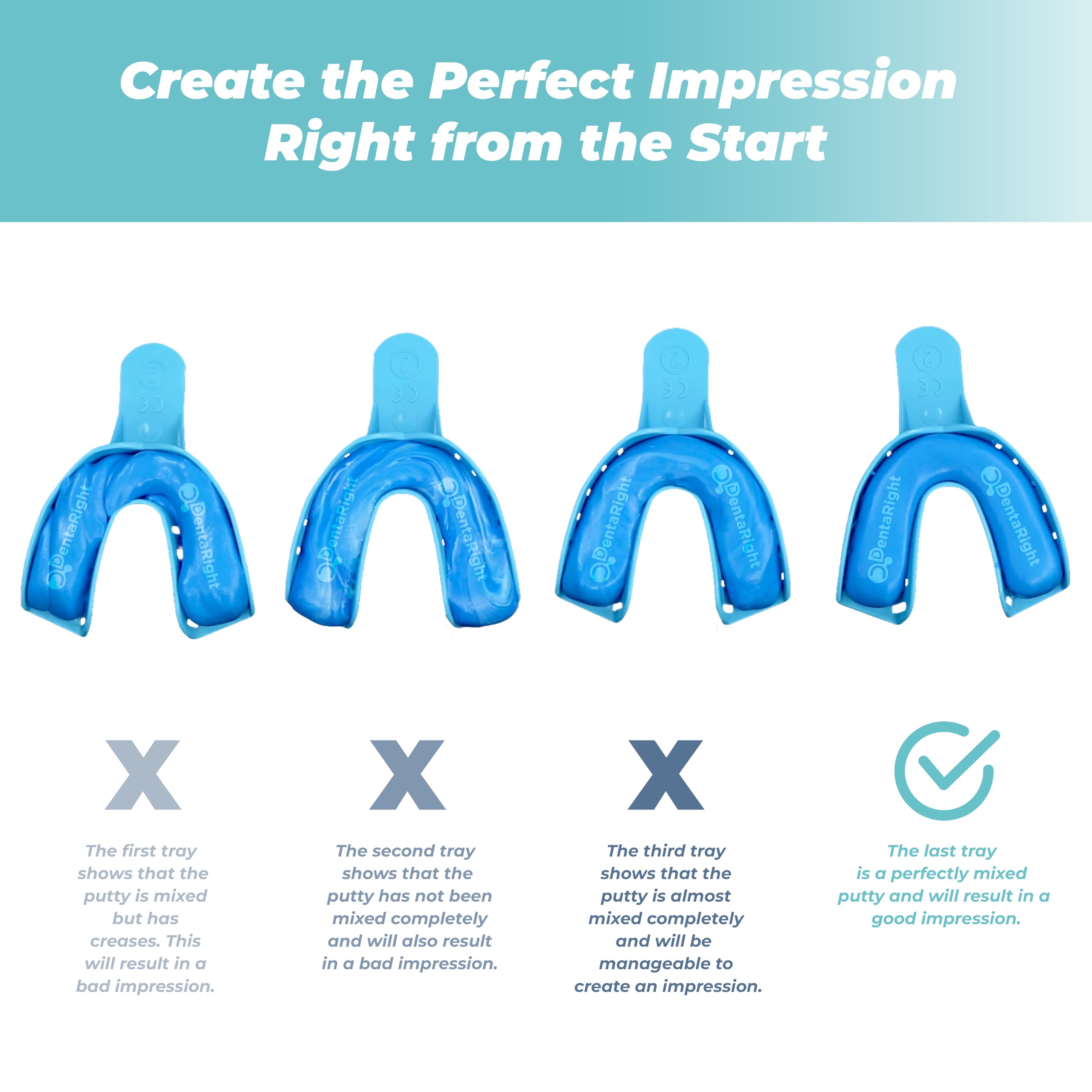 Mouth Guard for Teeth Grinding – Soft Custom-Fit Night Guard (1 Piece) – Upper or Lower