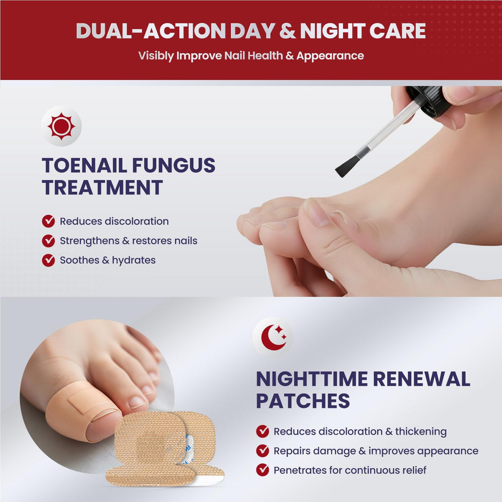 Treatonic Toenail Fungus Treatment Kit – Extra Strength 25% Undecylenic Acid + 32 Nighttime Patches