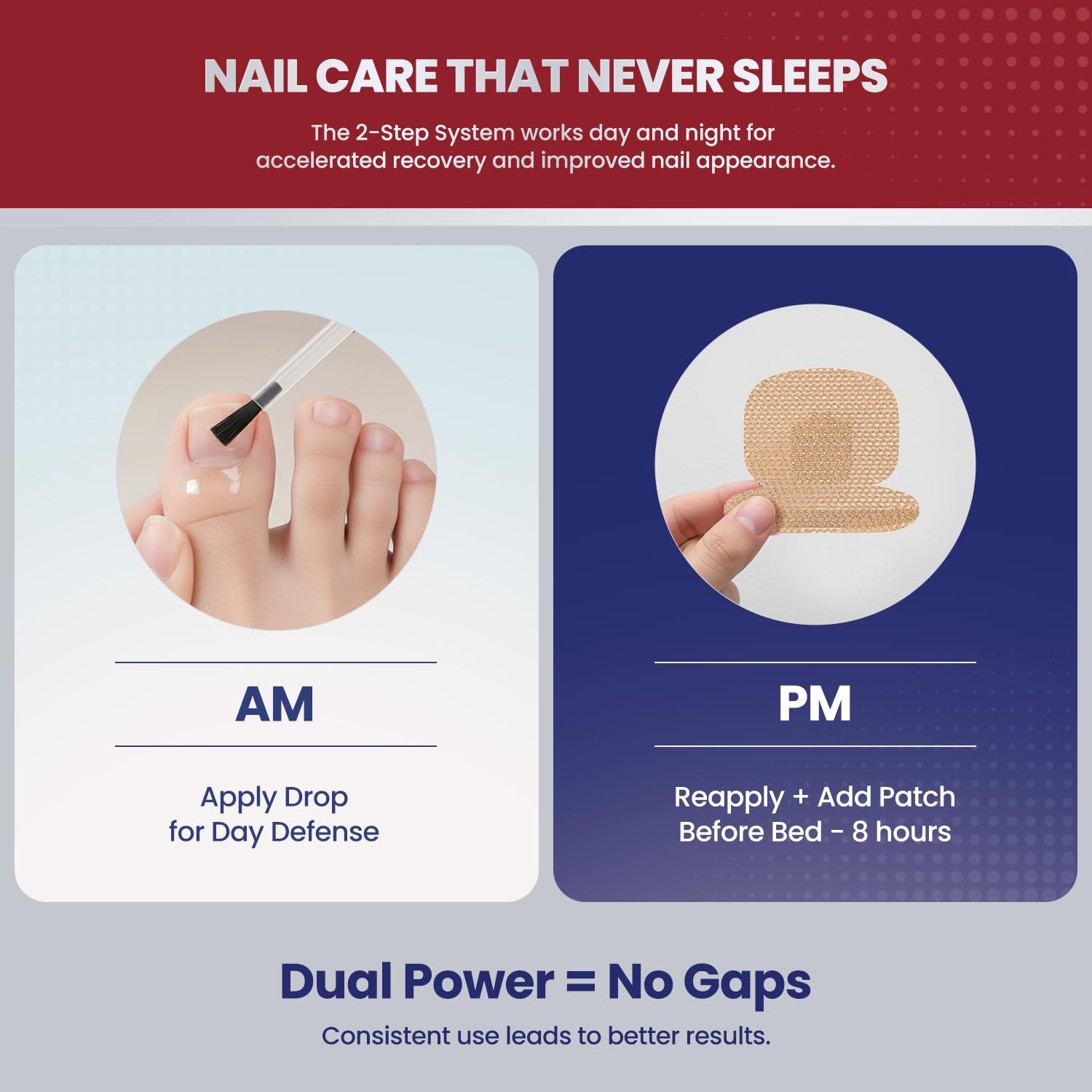 Treatonic Toenail Fungus Treatment Kit – Extra Strength 25% Undecylenic Acid + 32 Nighttime Patches