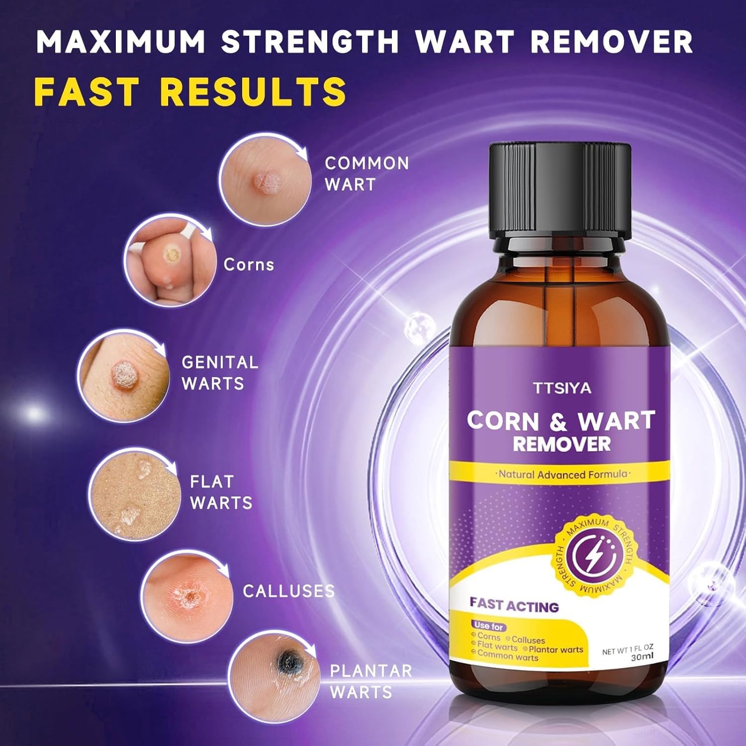 TTsiya Wart Remover Cream & Liquid Freeze Off – Fast Acting Salicylic Acid Wart Treatment (20g & 30ml)