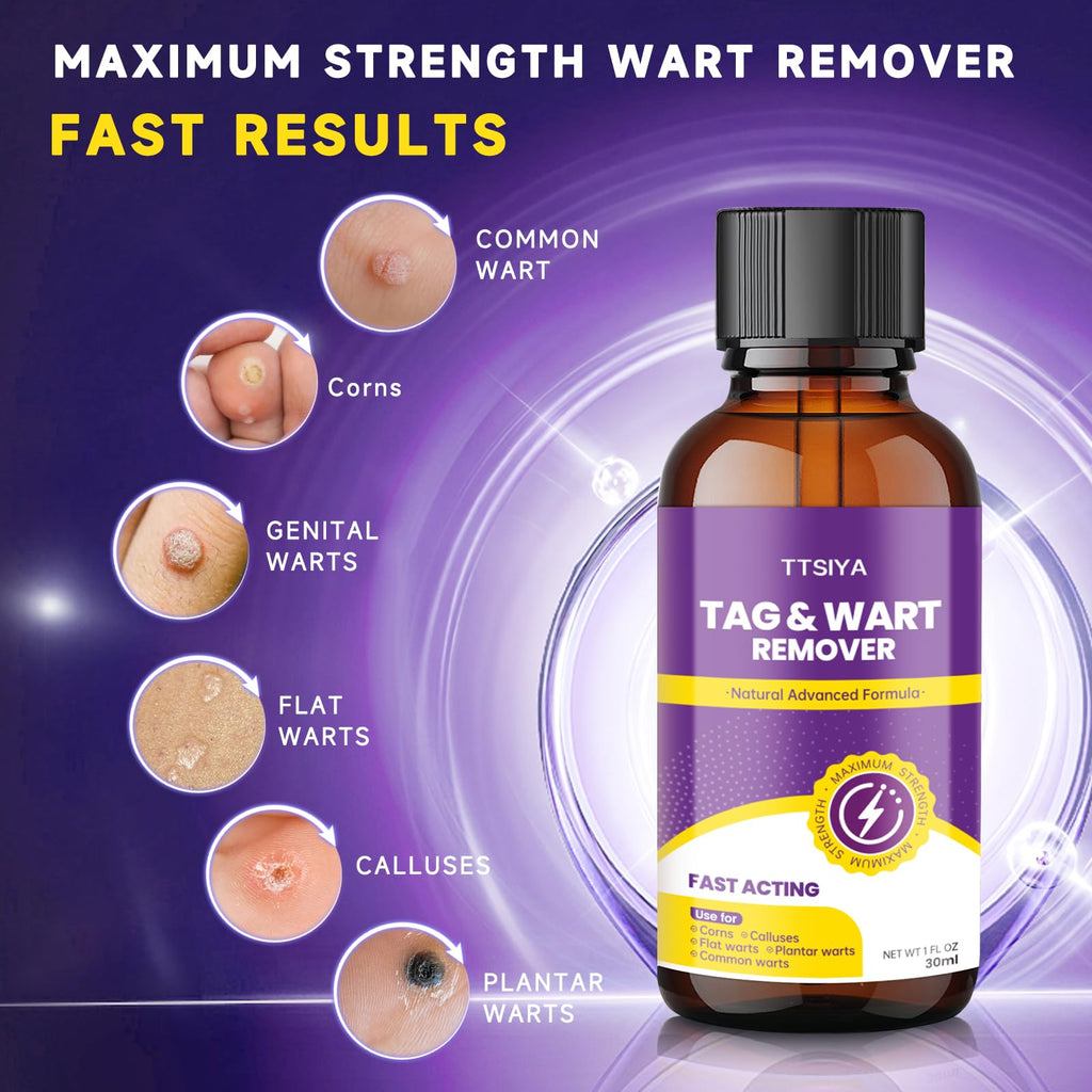 TTsiya Wart Remover Freeze Off – Fast-Acting Salicylic Acid Liquid (30 ml)