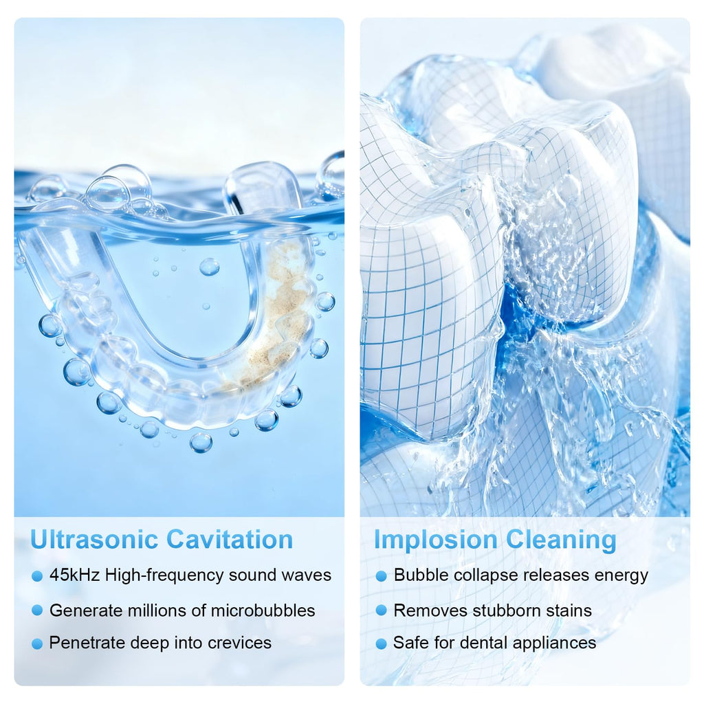 Upgraded Ultrasonic Retainer Cleaner - 45kHz, 200ml, White | For Dentures, Braces & Jewelry