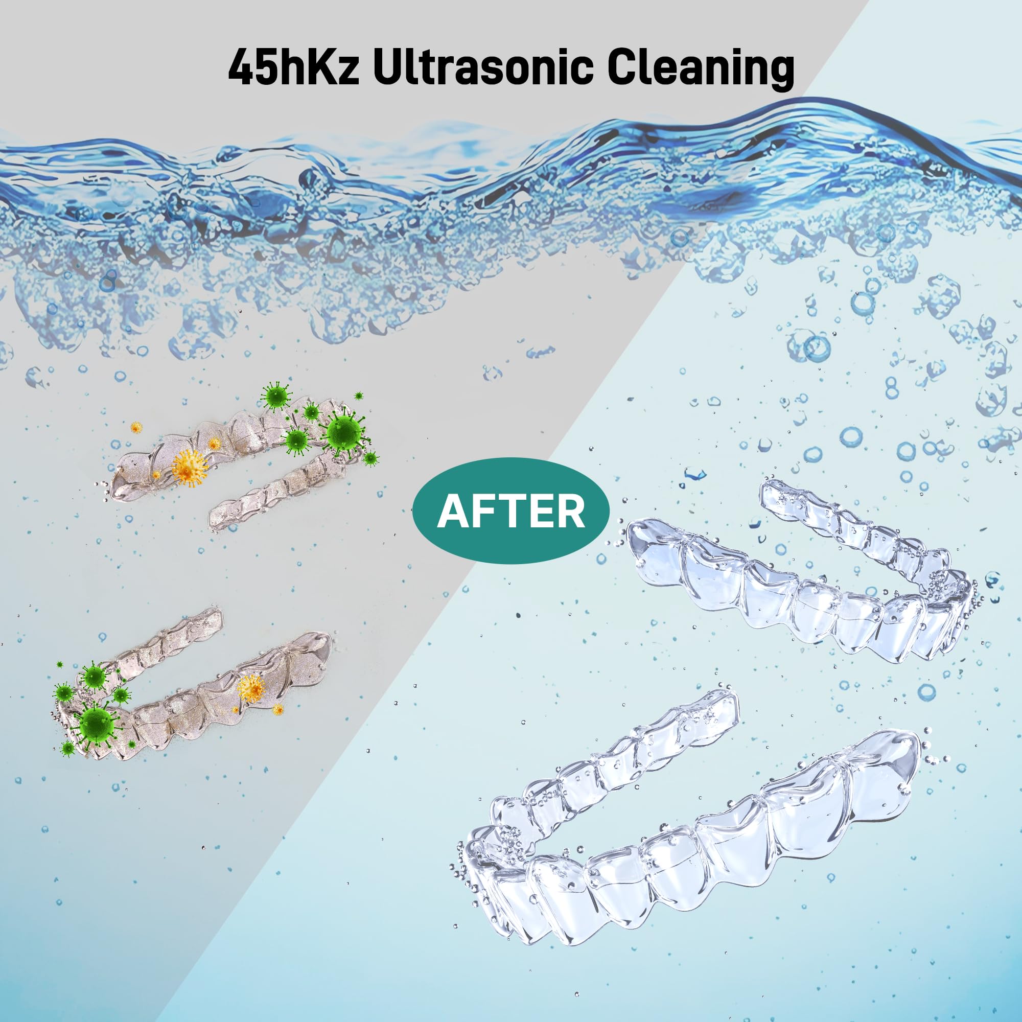 Ultrasonic Retainer Cleaner with UV Light - 45kHz Cleaning Pod (Black)