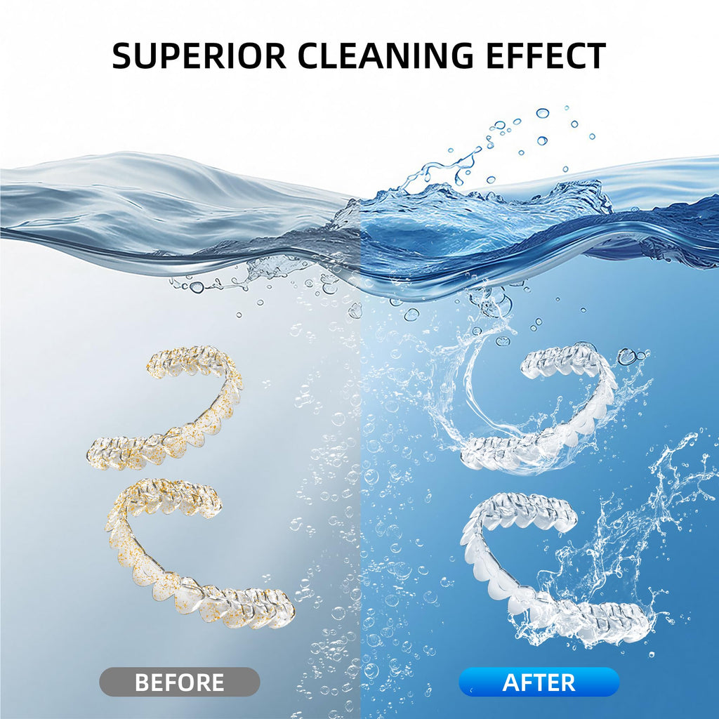 Ultrasonic Retainer Cleaner Machine - 48kHz Cleaning (13oz, White)