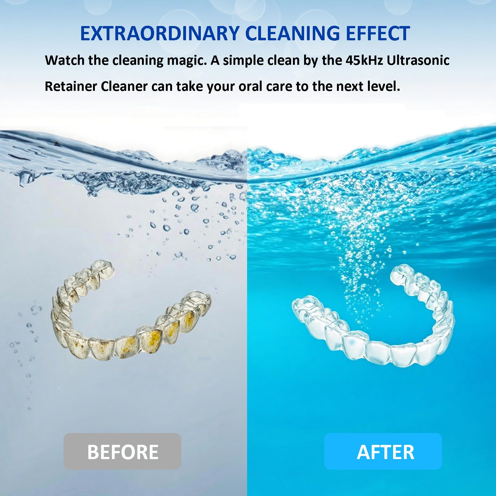 2025 Upgraded Ultrasonic Retainer Cleaner with Dryer Fan – 45kHz UV Cleaning Pod (White) | Dentures, Aligners & Jewelry