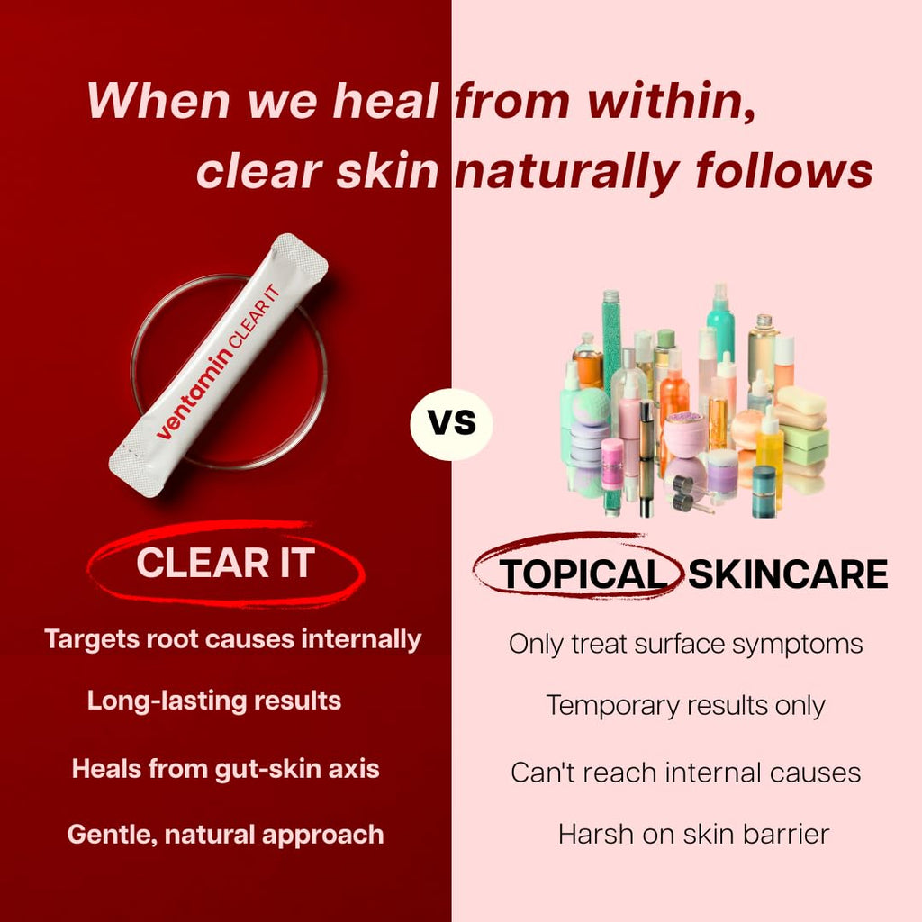 Ventamin Clear It Acne Supplement – Skin Detox with Probiotics, Zinc, Magnesium + 20 Actives (30 Sachets per Box)