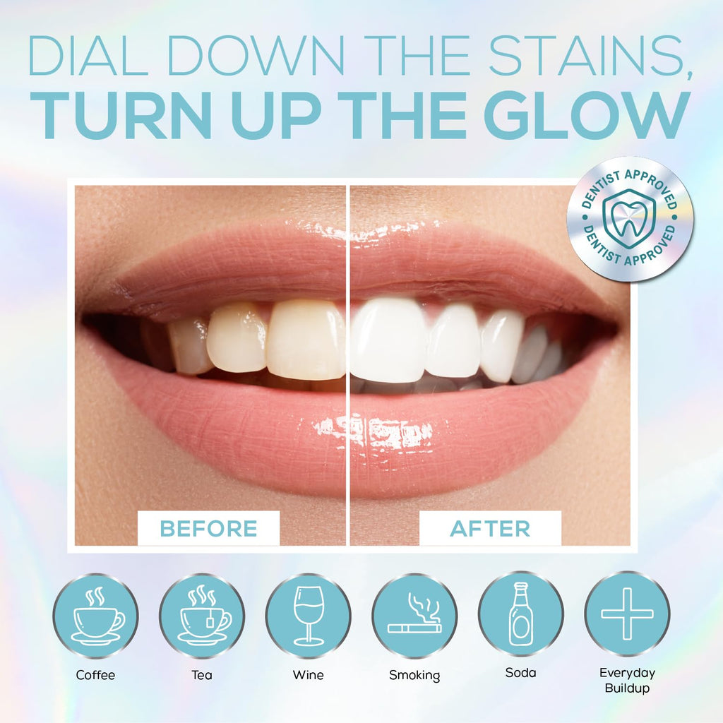 Venus Visage Teeth Whitening Kit with LED Light – 16-Min Non-Sensitive Whitening