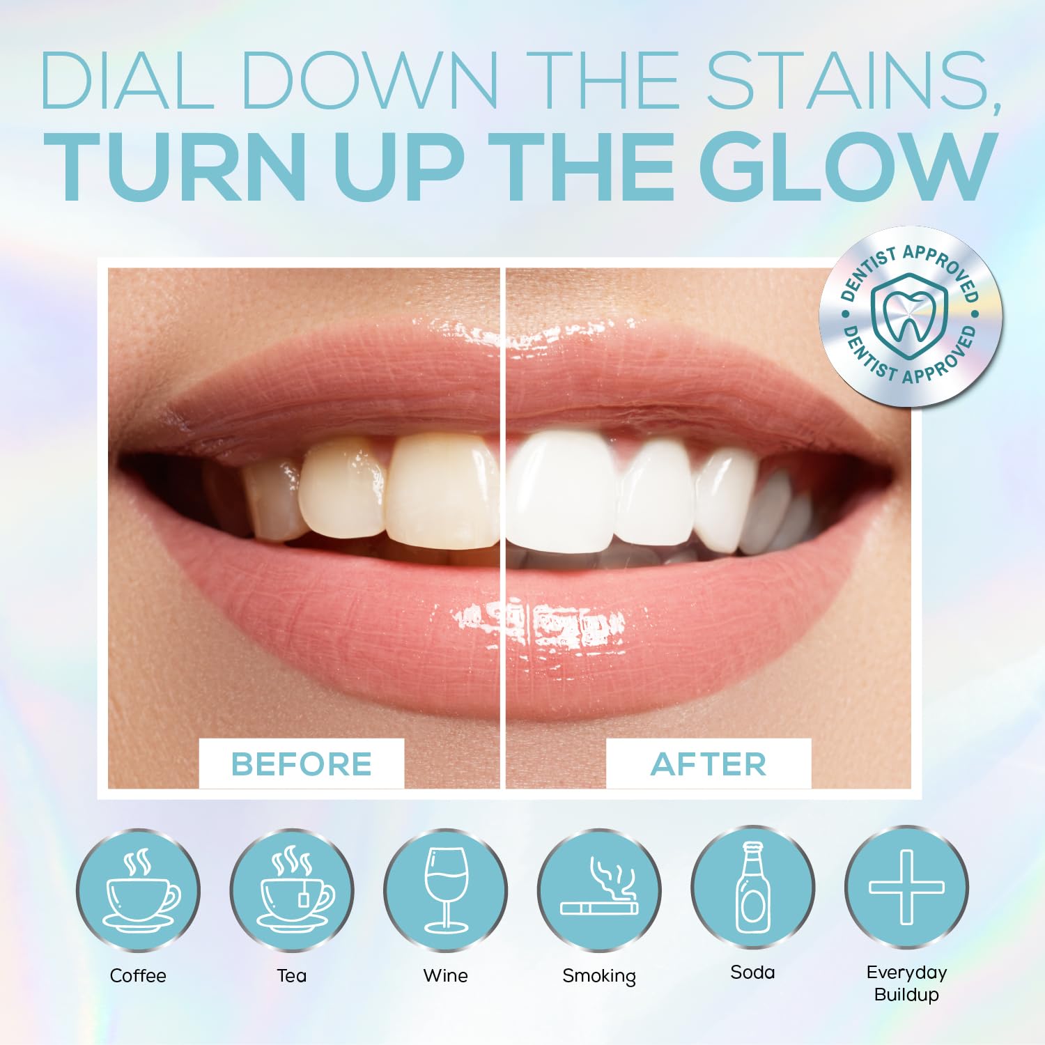 Venus Visage Teeth Whitening Kit with LED Light – 16-Min Non-Sensitive Whitening