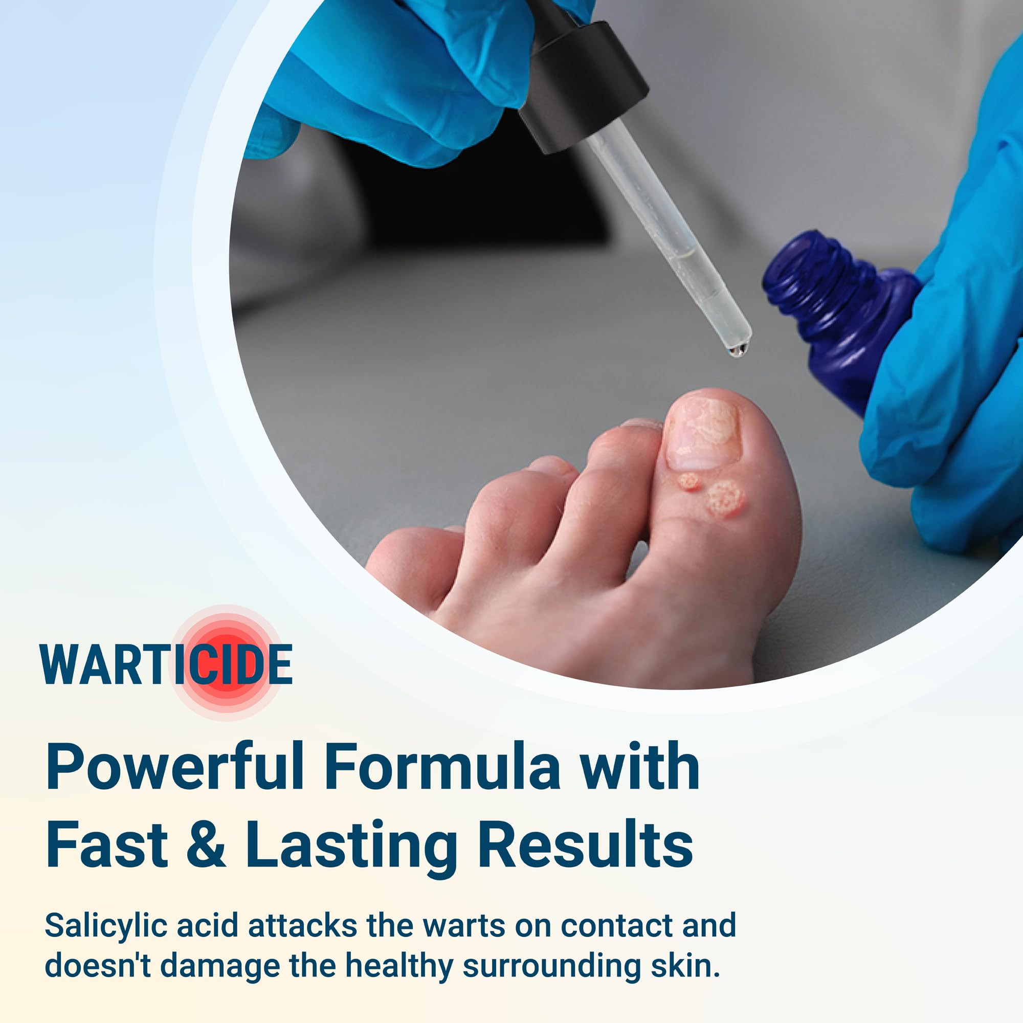 Warticide Liquid Wart Remover – 10% Salicylic Acid with Tea Tree & Cedar Leaf Oil | Made in USA | 1 Fl Oz Dropper
