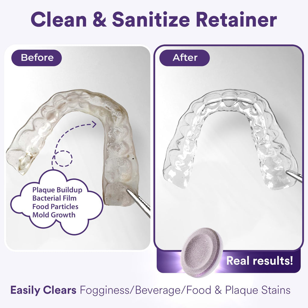 Weiss Naturals Retainer Cleaner Tablets – Persulfate-Free, 30 Tablets (Grape Scented)