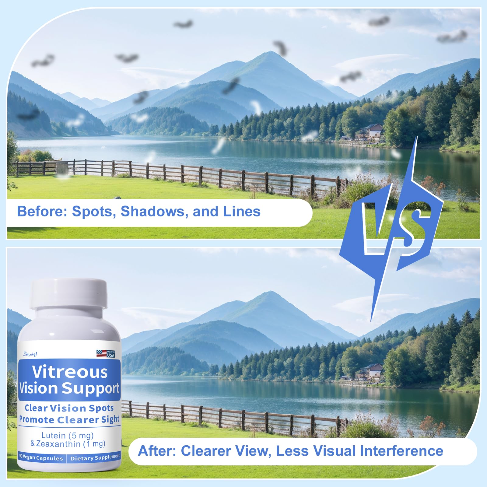 Zhizaiql Eye Vitamin with Lutein & Zeaxanthin – Supports Vitreous Clarity & Clear Vision, 90 Vegan Capsules