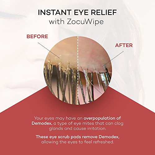 Zocuwipe Eyelid Wipes with Natural Okra Complex — Gentle Cleanse & Moisturize (30ct)